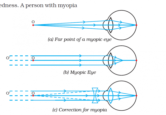 far point of eye